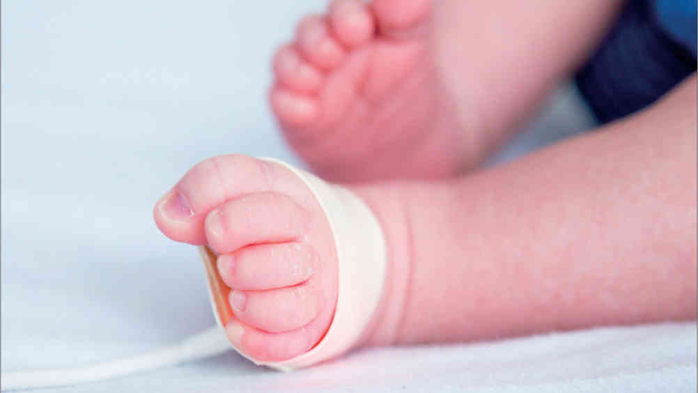  Pulse oximetry screening is an accurate way of determining how much oxygen is in a newborn's blood stream