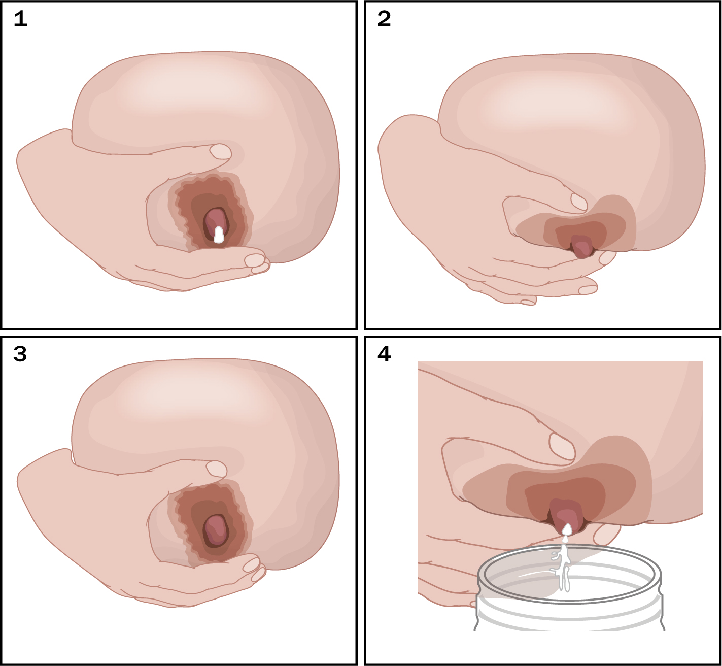 The colostrum collection system hand expression funnel shown connected