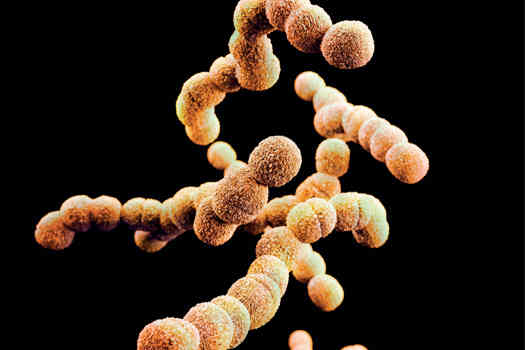 Group B Streptococcus (GBS) causes the death of around 50 babies every year