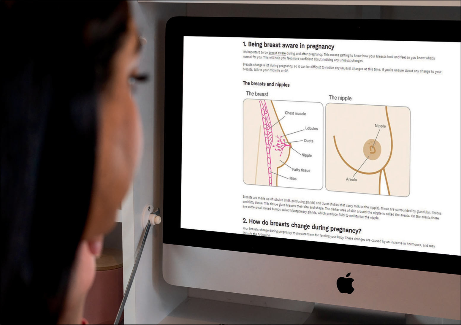 Normal Breast Changes in Pregnancy